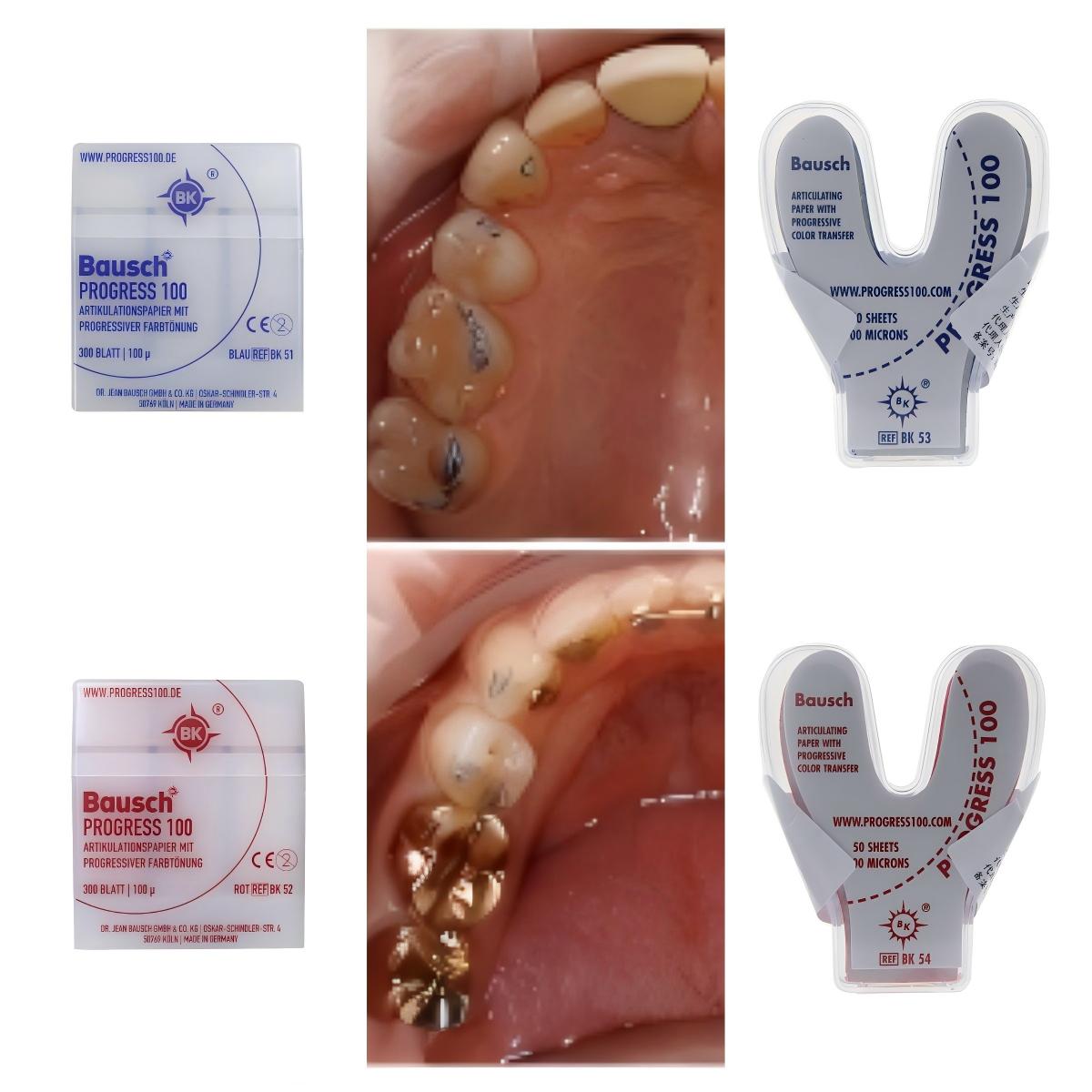 Papel de Articulação Odontológ - Bite Indicator avaliação e preço